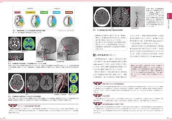 脳卒中最前線 ほぼ新品 楽天市場】脳卒中最前線の通販