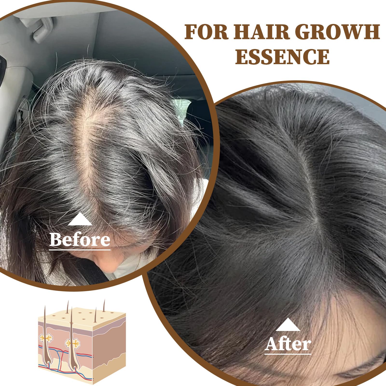 2PCS Rice Water for Hair Growth Rice Water Hair Serum for Dry Damaged Hair Rice Hair Growth Oil for Thinning Hair and Hair Loss,Deeply Nourishes Hair Scalp Growth Serum Strengthening Anti-Hair Loss - Image 3