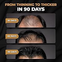 Vista 2 de Champú Activador de Raíces SPARTAN™ para Hombres - Champú para el Crecimiento del Cabello para la Pérdida de Cabello y Cabello Delgado