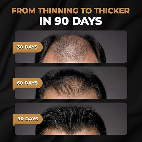 Miniatura 2 de SPARTAN Acondicionador activador de raíces para hombres, acondicionador para el crecimiento del cabello, hidratante para engrosar el cabello y