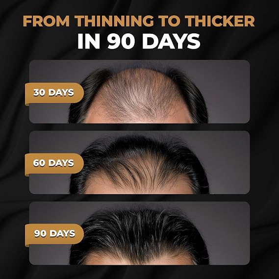 SPARTANTM Root Activator Conditioner For Men - Hair Growth Conditioner, Thickening Hair Moisturizer for Hair Loss and Thinning Hair