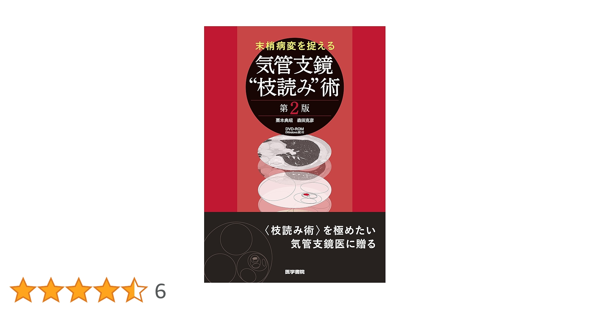 末梢病変を捉える気管支鏡\"枝読み\"術 末梢病変を捉える気管支鏡“枝読み”術 / 栗本典昭/森田克彦