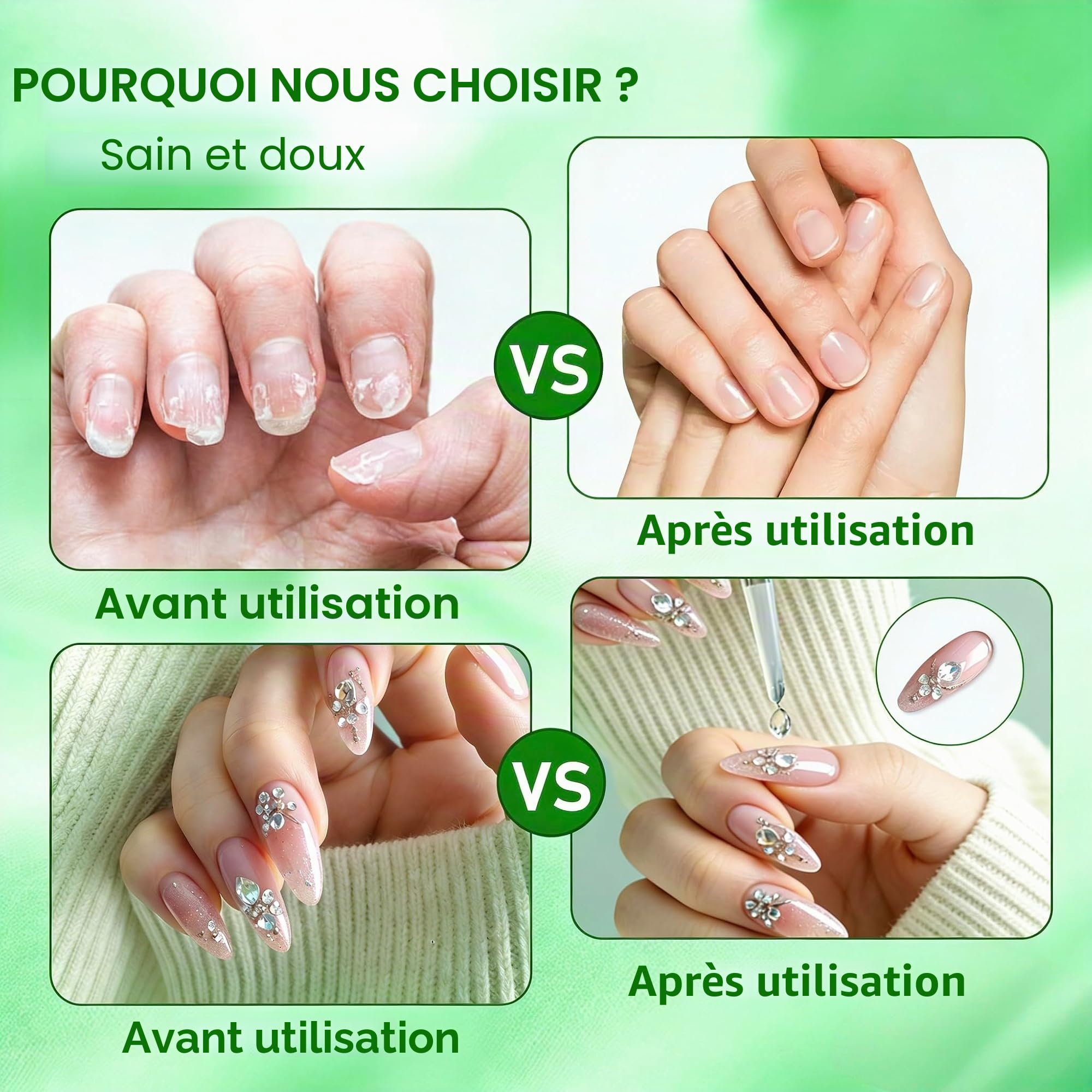 2 Pièces 15ml Magic Remover pour Faux Ongle, Dissolvant Vernis Semi Permanent, Gel Nail Polish Remover, Sans Abîmer les Ongles, Avec Limes à Ongles et Grattoir à Cuticules