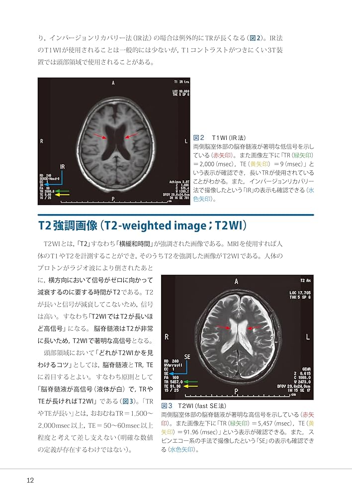頭部CT・MRIの撮像・読影マスター | 扇 和之, 内山史也, 西村