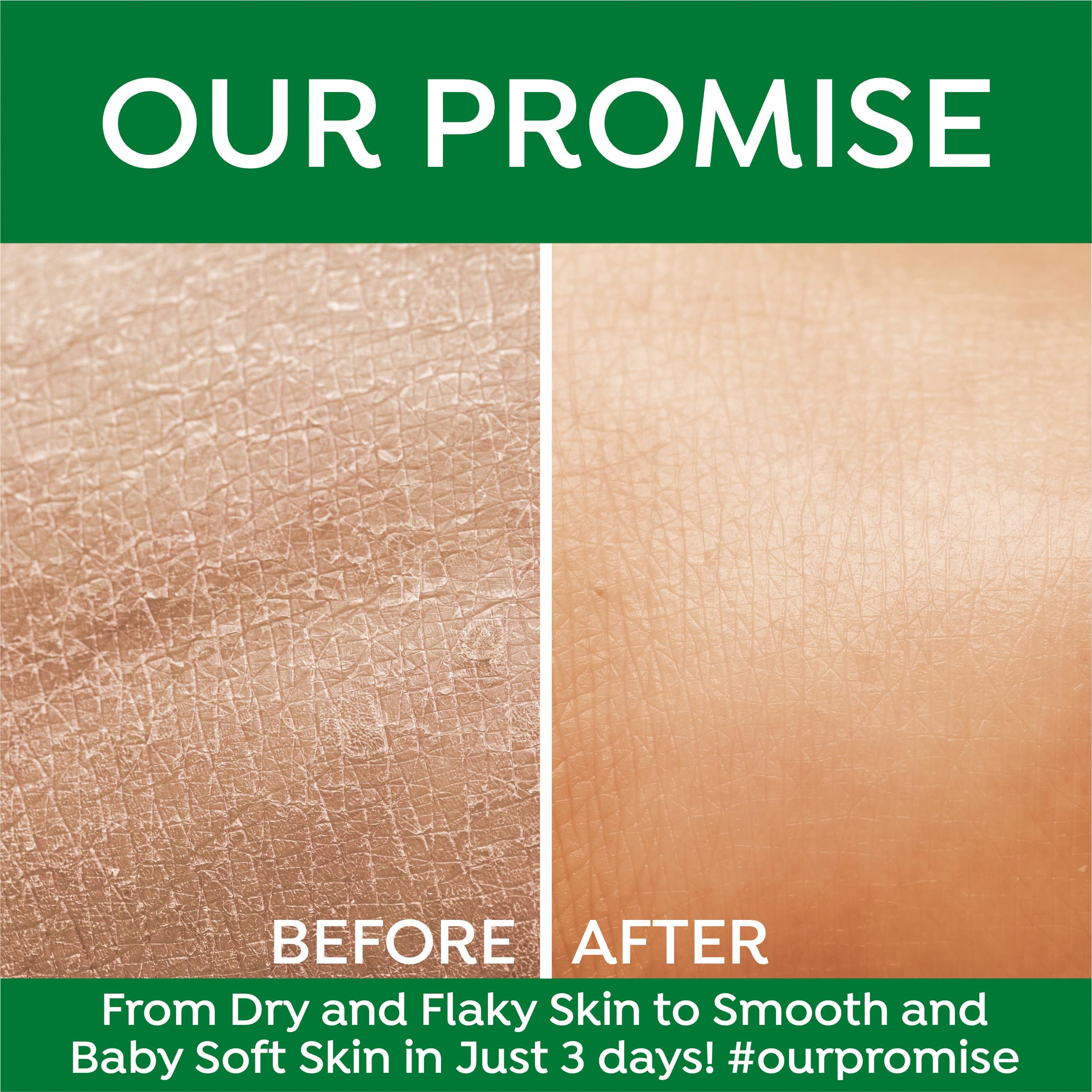 Bee One 24 Hr Aloevera Moisture Lock Body Lotion 1000ml | Hydrating Formula for Soft & Supple Skin, Long-Lasting Moisture & Nourishment | Suitable for all skin types 4