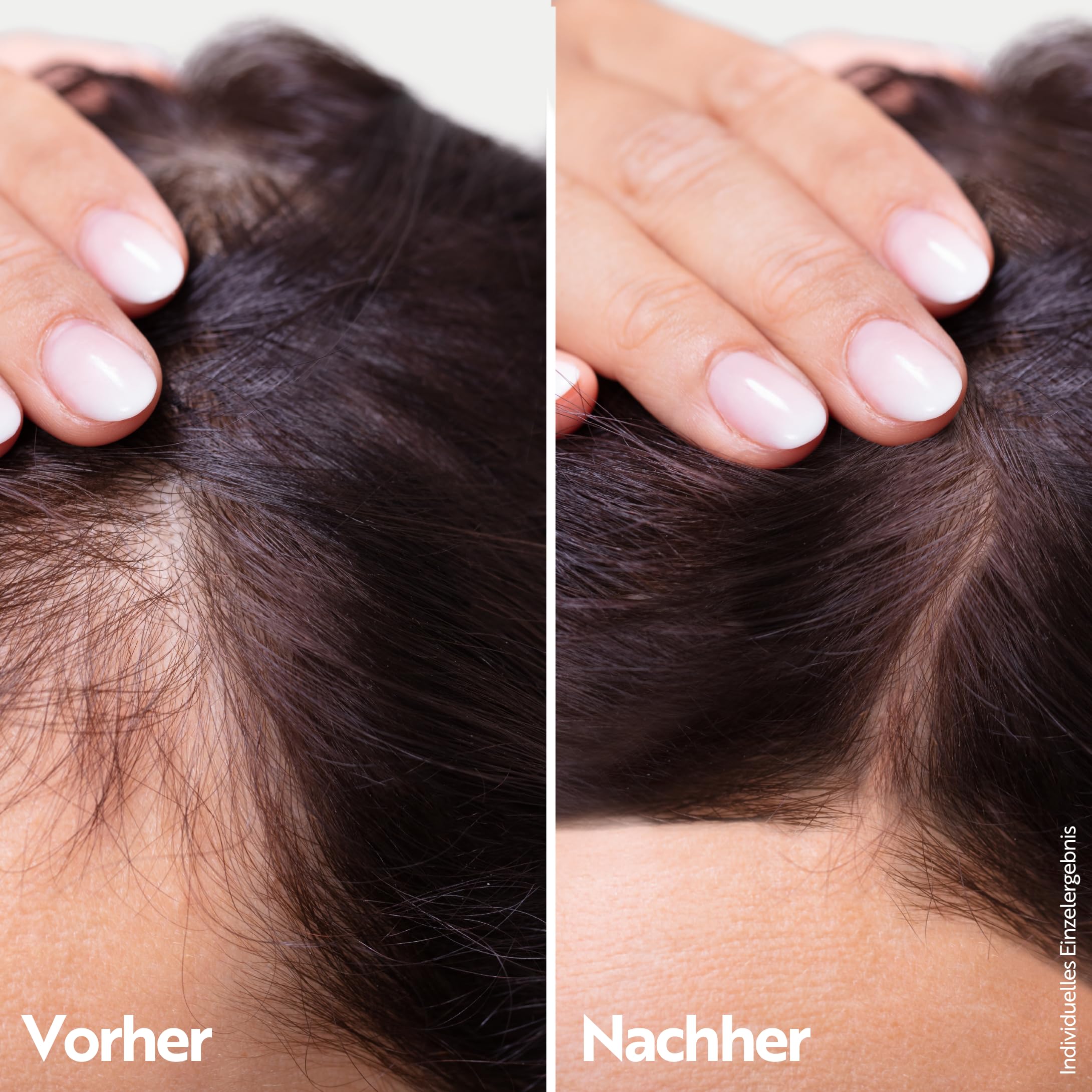 ahuhu ESSENTIAL ANTI-AGE Elixir Mit Koffein & Redensyl (100ml) - Hochkonzentrierte Kopfhautpflege Stimuliert Das Haarwachstum, Sorgt Für Dichteres Haar & Mehr Volumen, Vegan