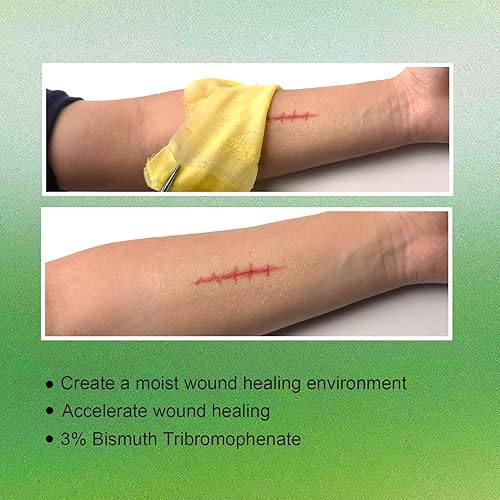 Miniatura 3 de Aderezo de vaselina Xeroform no adherente de 5 x 9 pulgadas, paquete individual de 25 unidades, parche de gasa de malla fina suave para cuidado de