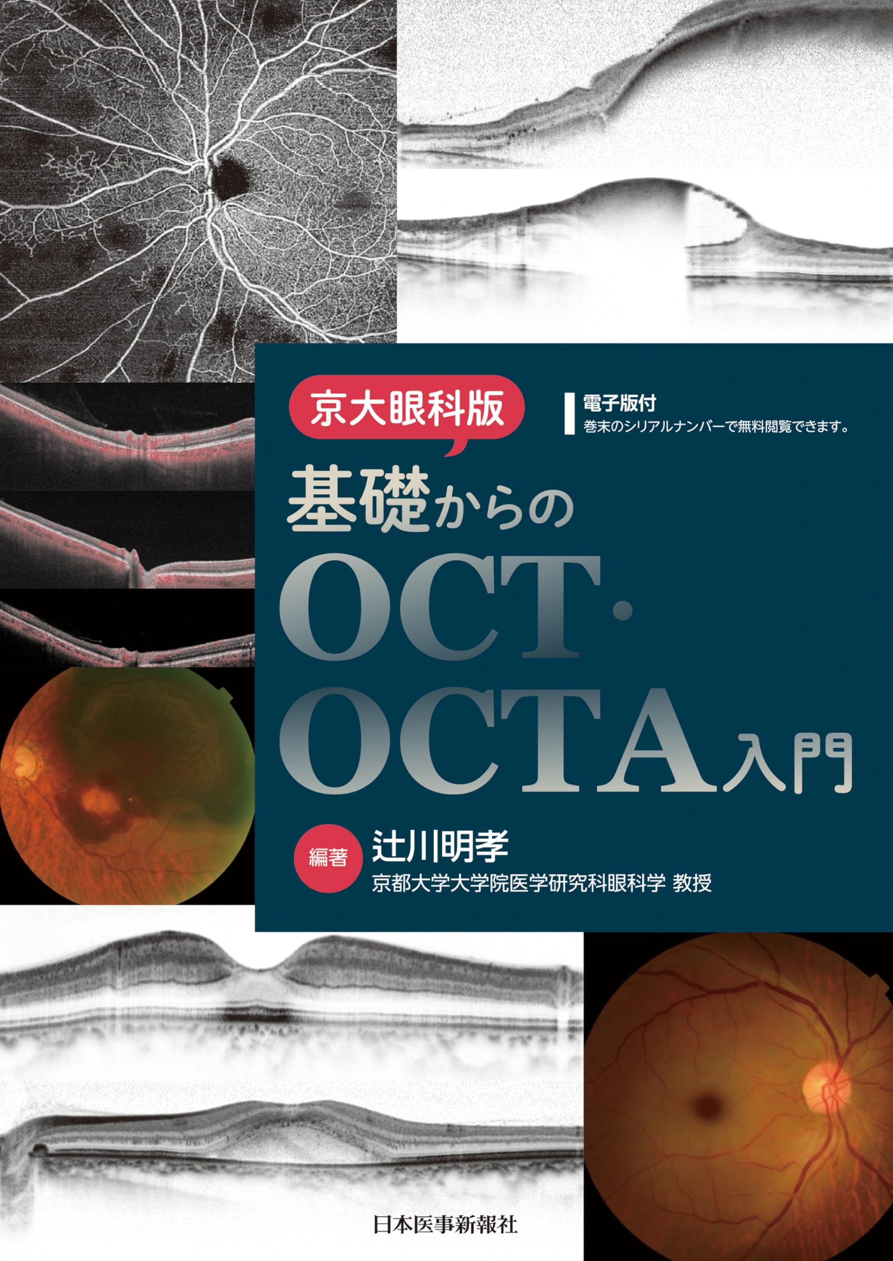 京大眼科版 基礎からのOCT・OCTA入門 | 辻川明孝 |本 | 通販 | Amazon