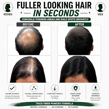 THICK FIBER Hair Fibres | Hair Powder for Thinning Hair 25g Bottle | Makes Thin Hair Look Thicker in Seconds | Hair Loss Concealer For Women & Men (Black)