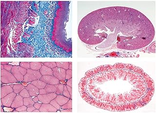 3B Scientific GmbH W13301F Series II. Metabolism-French OHP Transparency