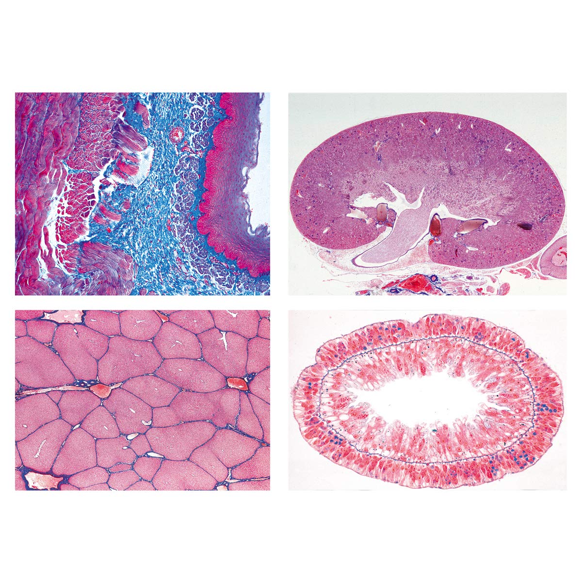 3B Scientific GmbH W13301P Series II. Metabolism -