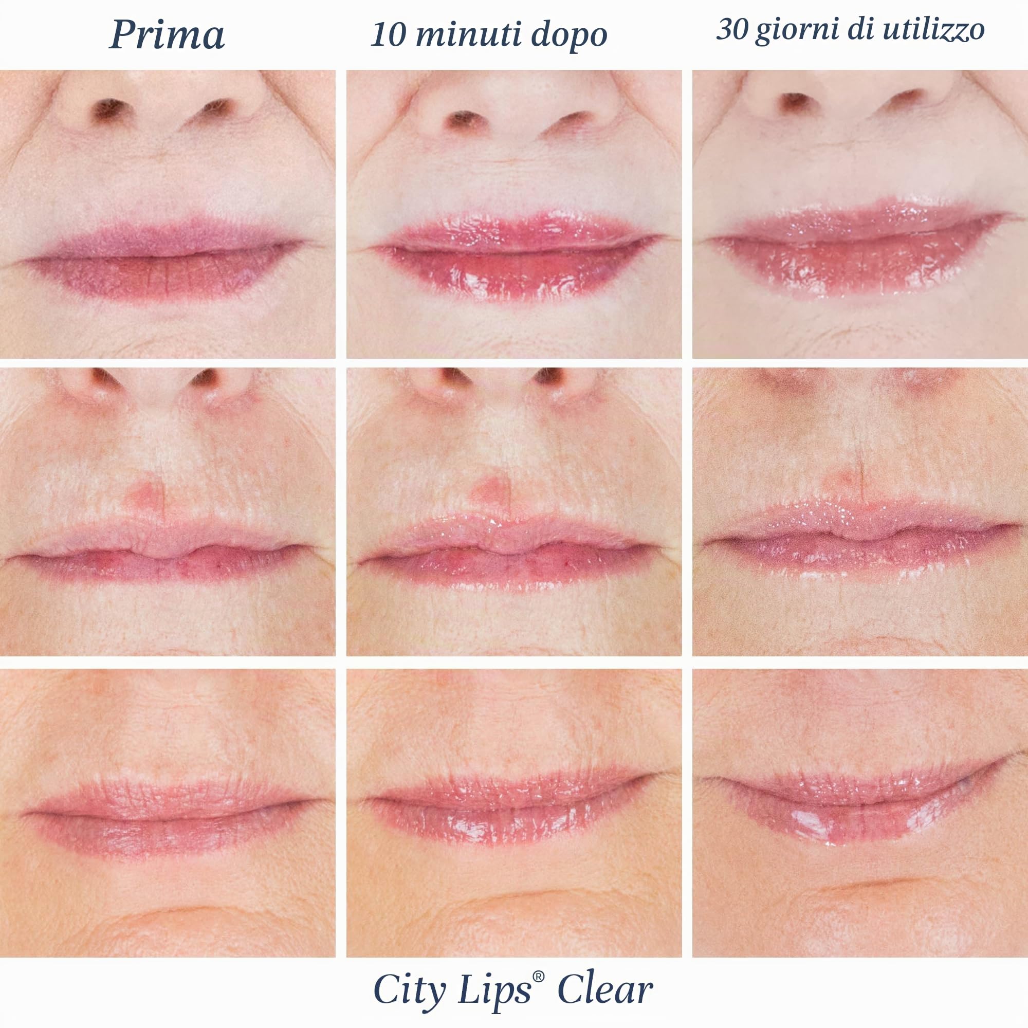 City Lips Lucidalabbra Rimpolpante – Lucidalabbra Idratante con Acido Ialuronico | Oli per un Effetto Volume e Labbra Più Piene e Giovani