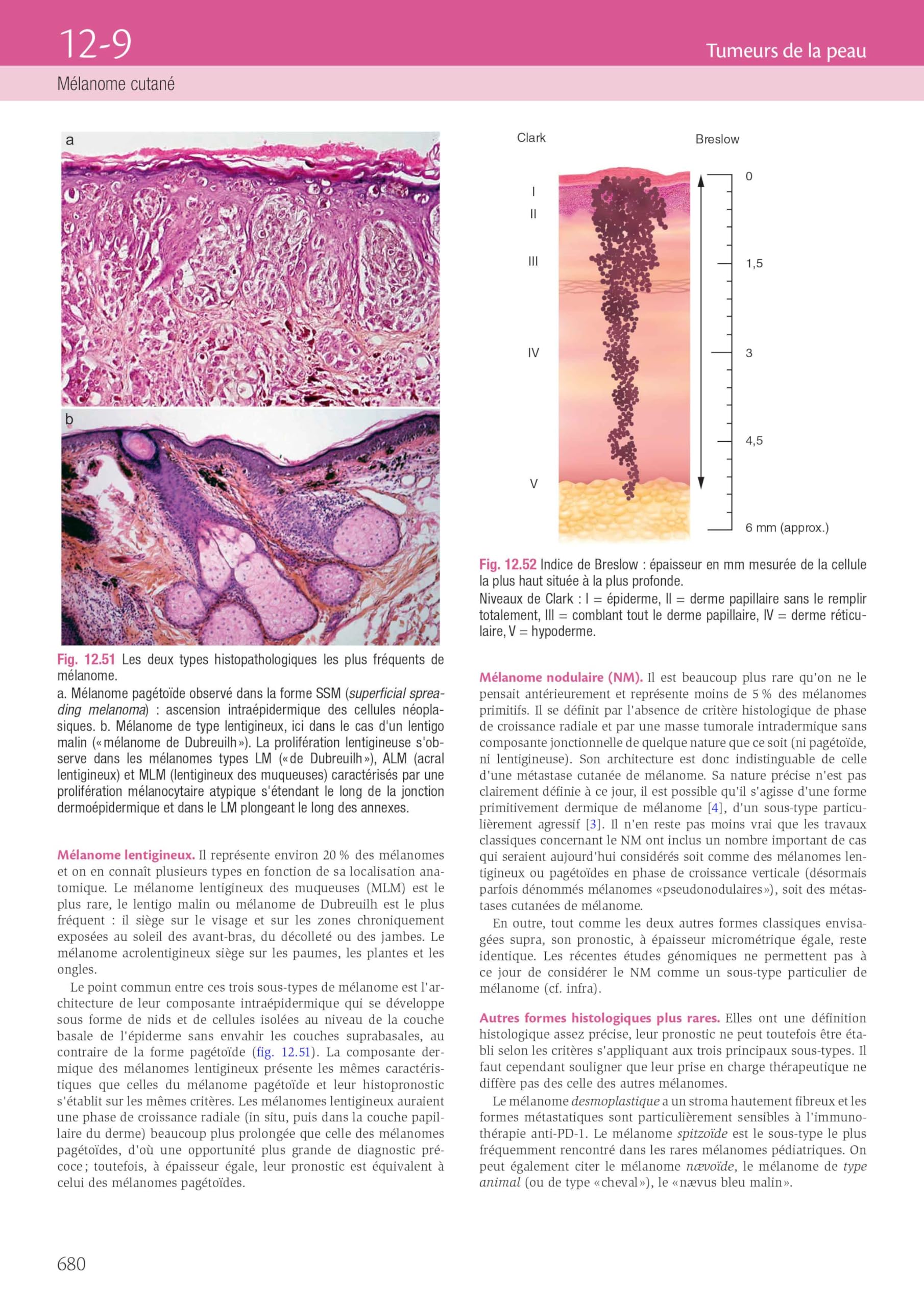 Dermatologie et infections sexuellement transmissibles: Avec ebook