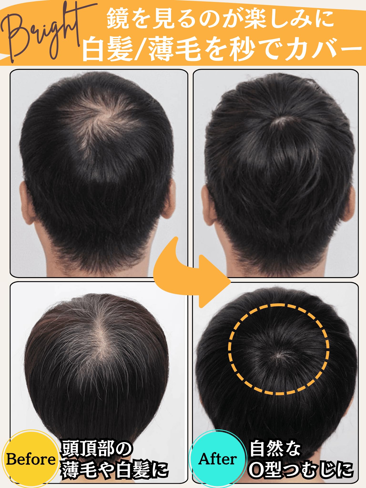 Amazon.co.jp: Luce brillare ヘアピース 人毛 部分ウィッグ 医療用