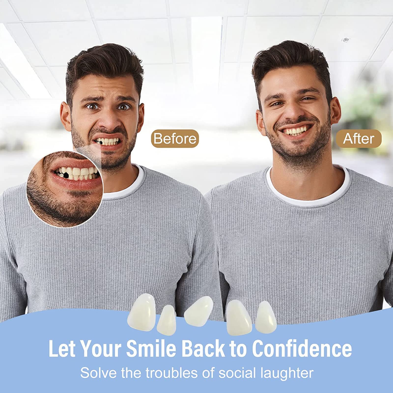 Temporary Tooth Repair Kit, Fake Teeth Replacement for Filling The