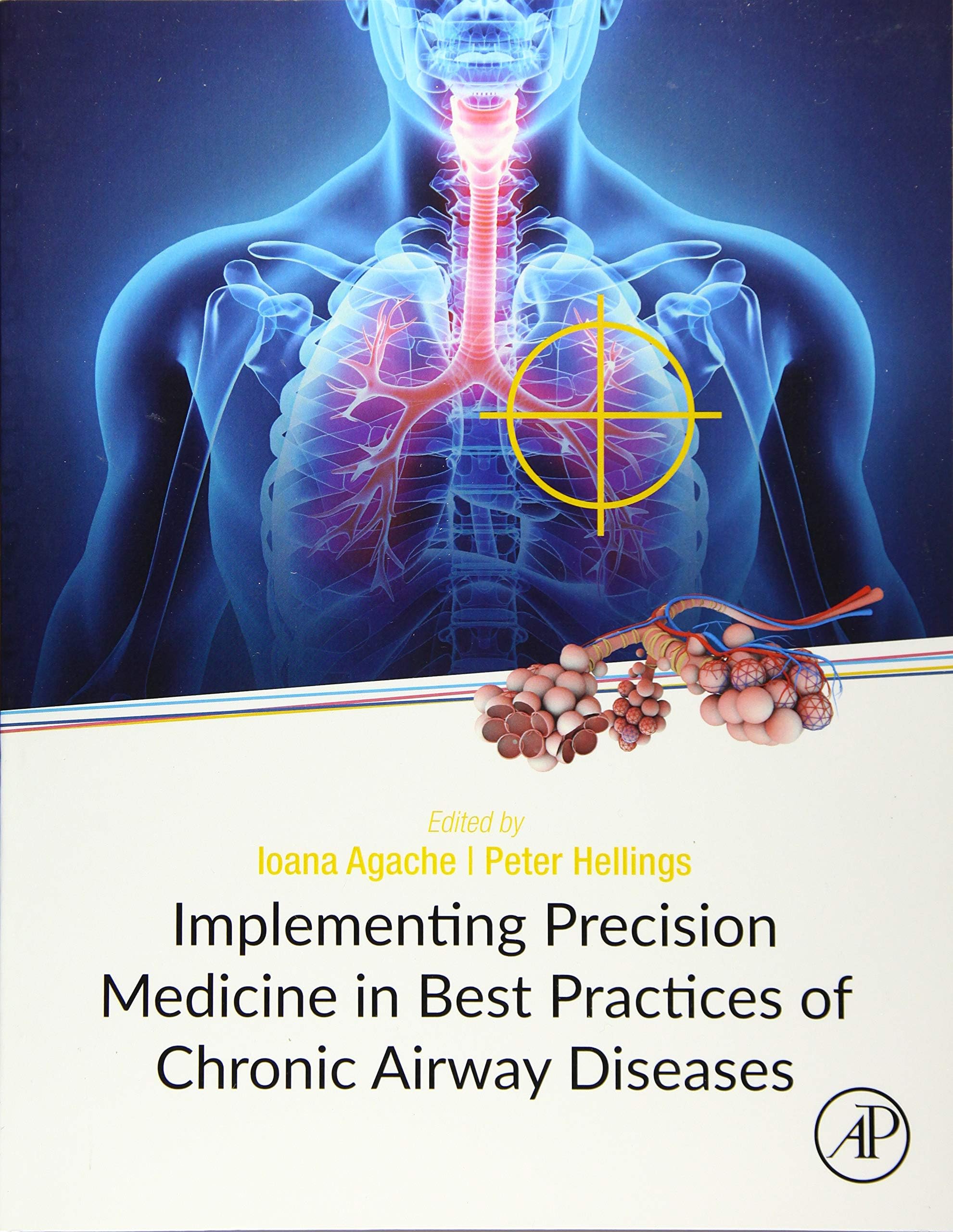Implementing Precision Medicine in Best Practices of Chronic Airway Diseases