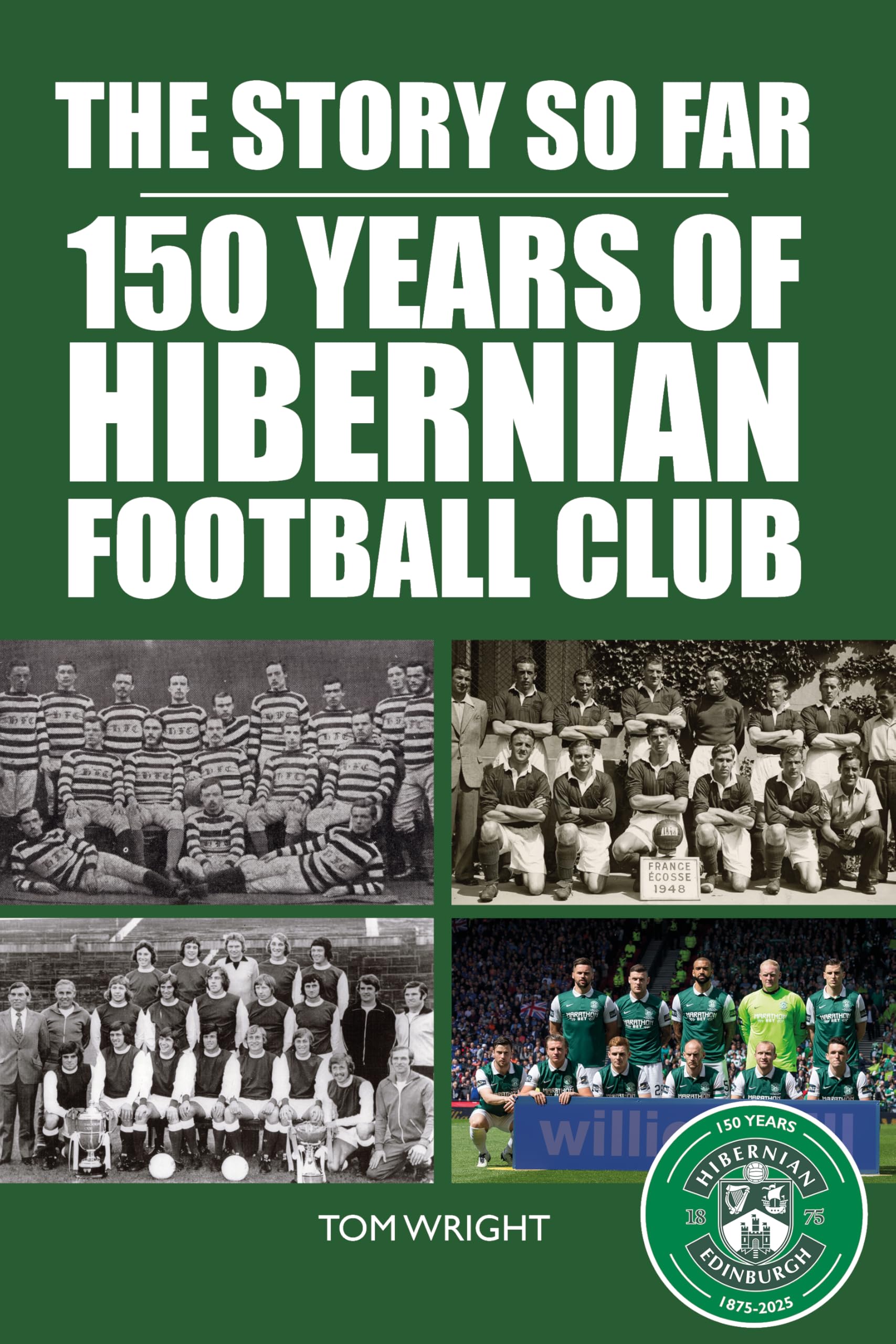 The Story so Far: 150 Years of Hibernian Football Club