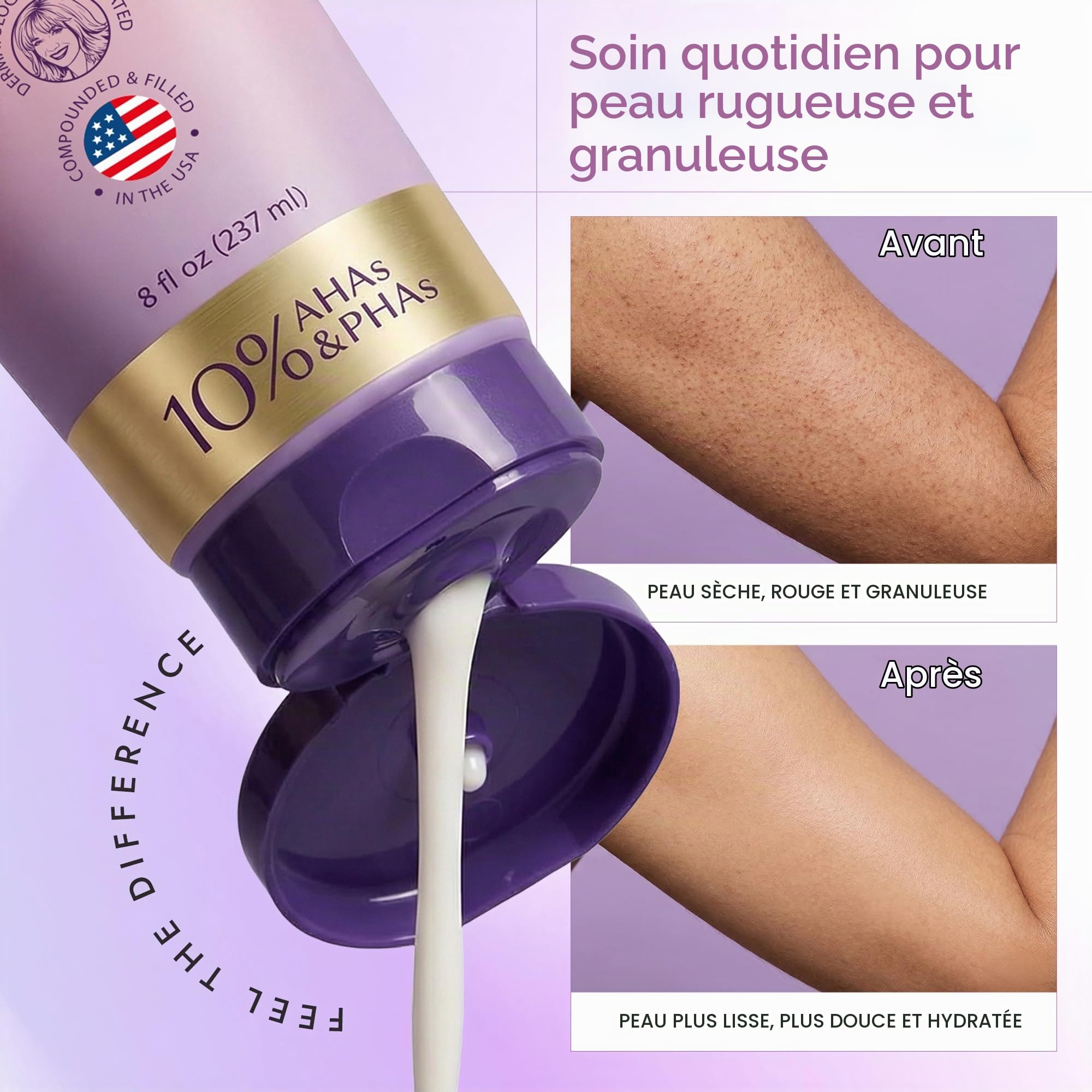 DERMAdoctor Creme Keratose Pilaire – Lotion hydratante pour le corps formulée par des dermatologues pour la kératose pilaire | Lisse la peau sèche, rugueuse et bosselée | Hydrate et adoucit (237ml)