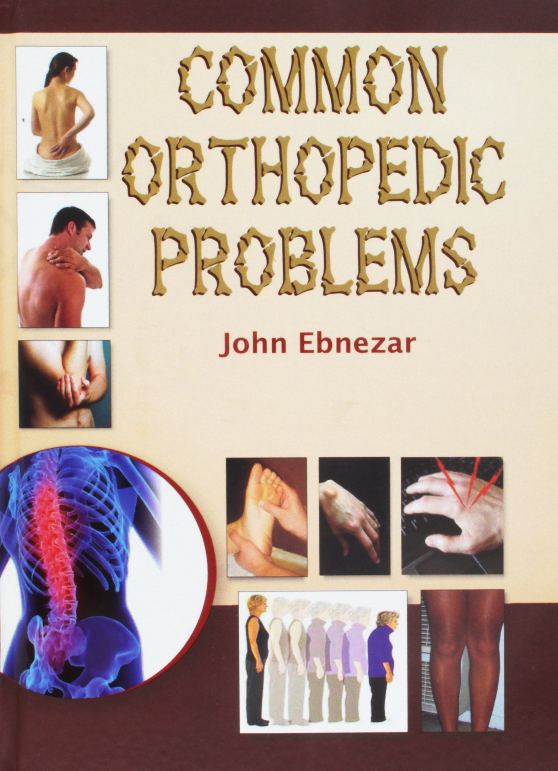 Common Orthopedic Problems