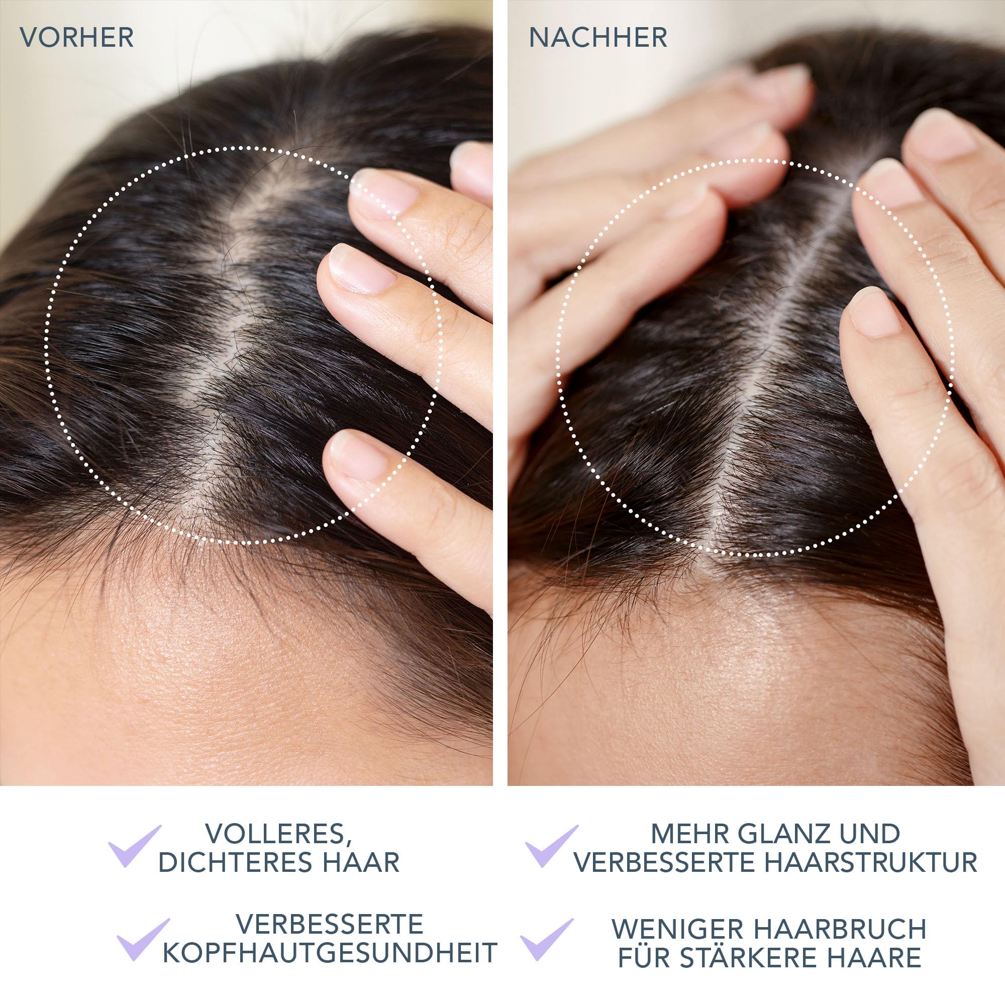 LUNA 4 Hair 2-In-1-Kopfmassagegerät für Haarwuchs mit Rotlicht - Silikon-Kopfhautmassagegerät & Cleanser - Elektrische Kopfhautmassagebürste für Haarwuchs