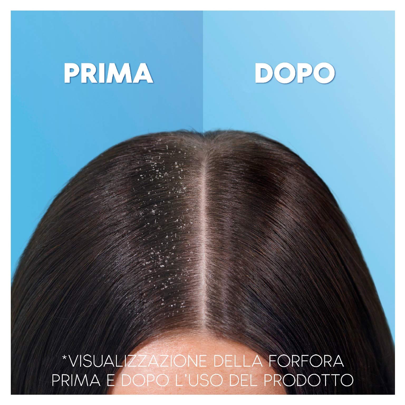 Head & Shoulders Classic Clean 2in1 Antiforfora Shampoo E Balsamo Per Capelli, 225ml, Confezione da 6
