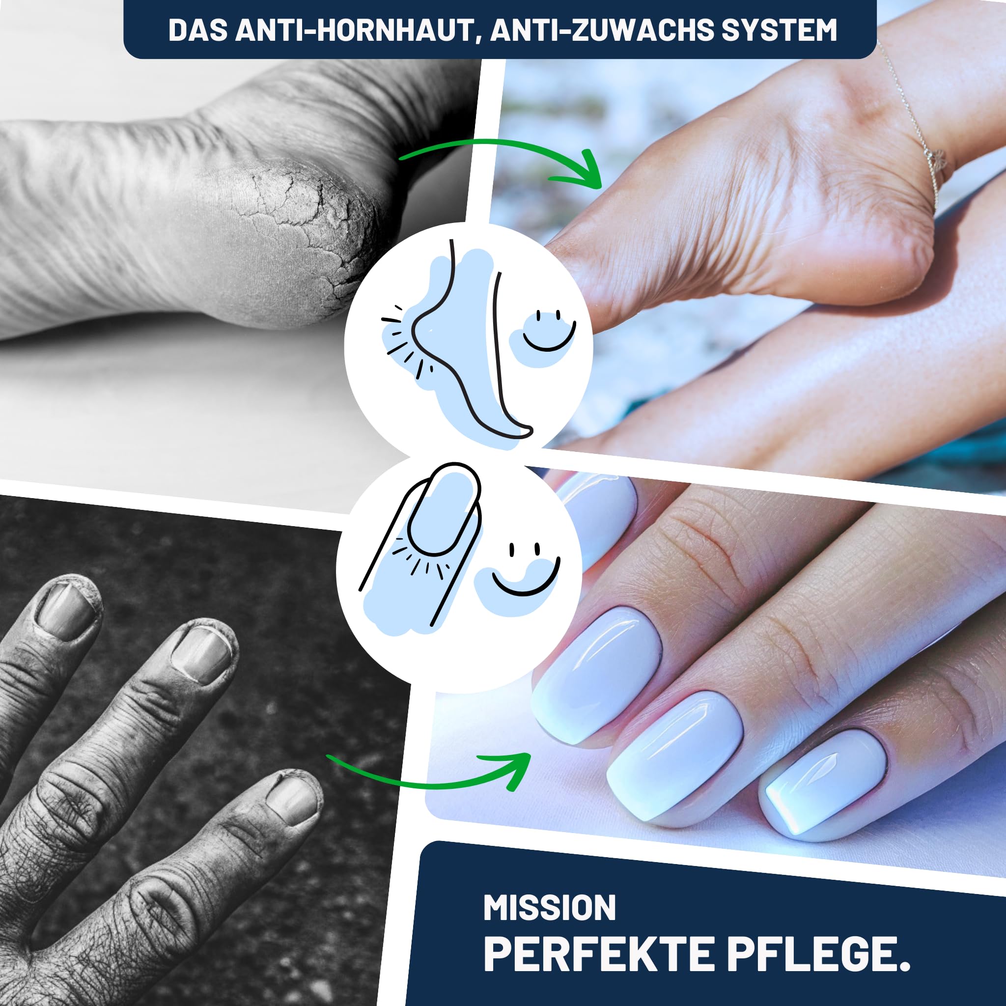 Mr. Fuss Soluzione attiva n. 4 Plus Pack Steel Classic – 3 pezzi per la cura dei piedi della calli
