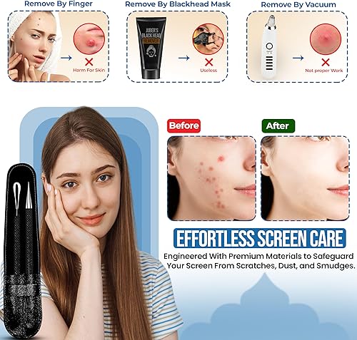 Miniatura 4 de EFAH Care - Extractor de espinillas de acero inoxidable, herramienta de tratamiento de acné, removedor quirúrgico de puntos negros, perfecto para