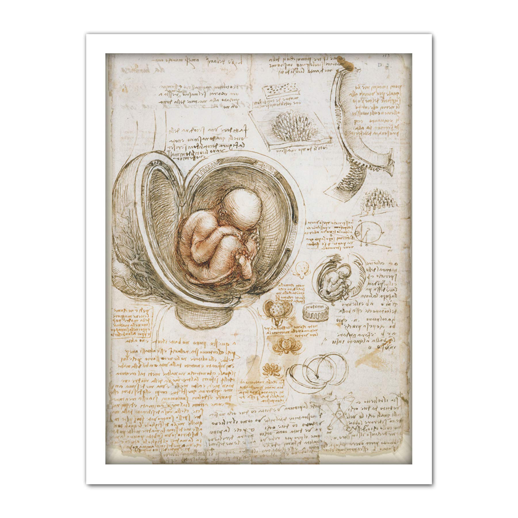 Artery8 Leonardo Da Vinci Studies Of The Foetus In Womb Artwork Framed Wall Art Print 18X24 Inch