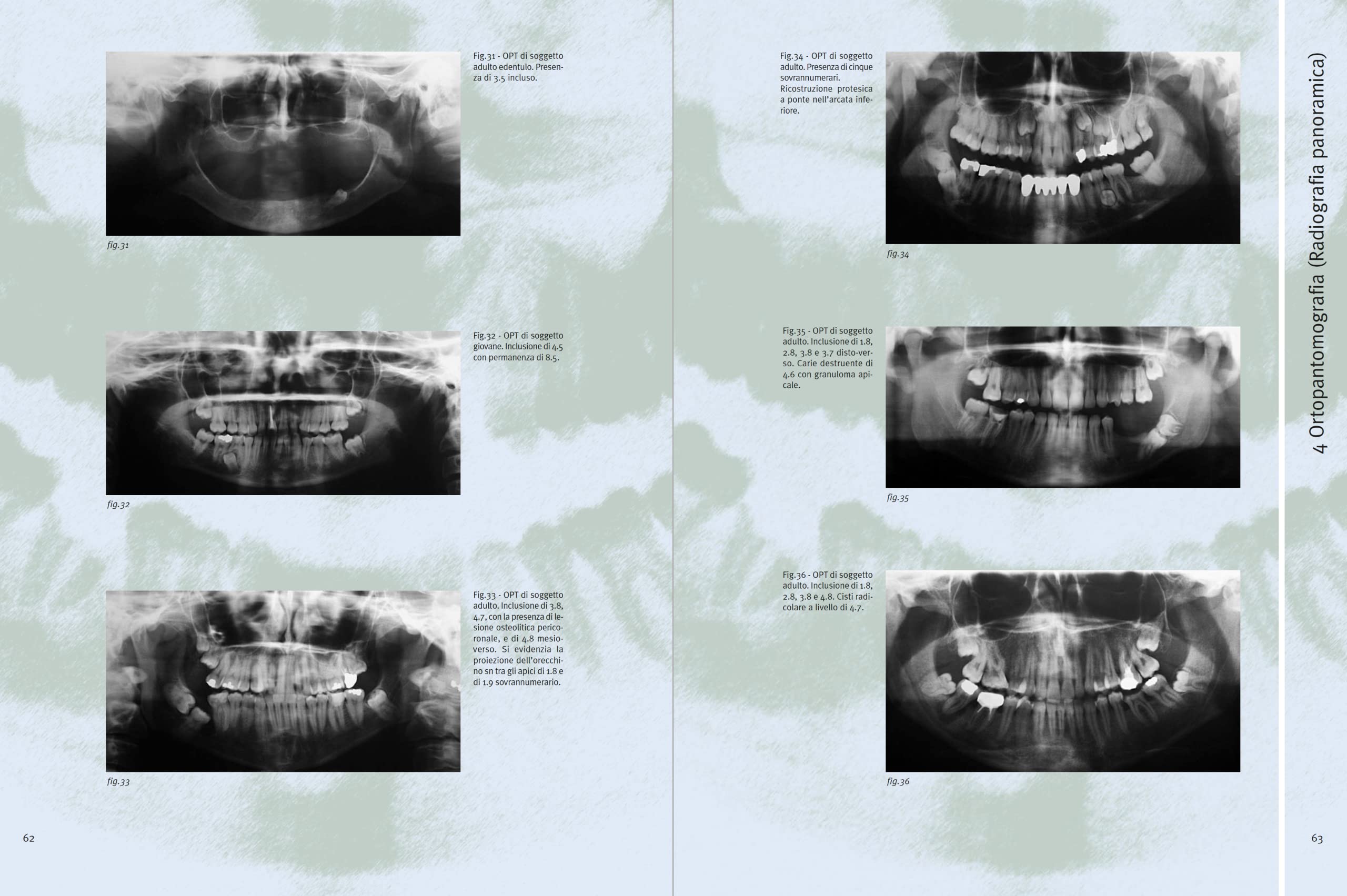 Atlante di radiologia odontoiatrica. A fini diagnostici