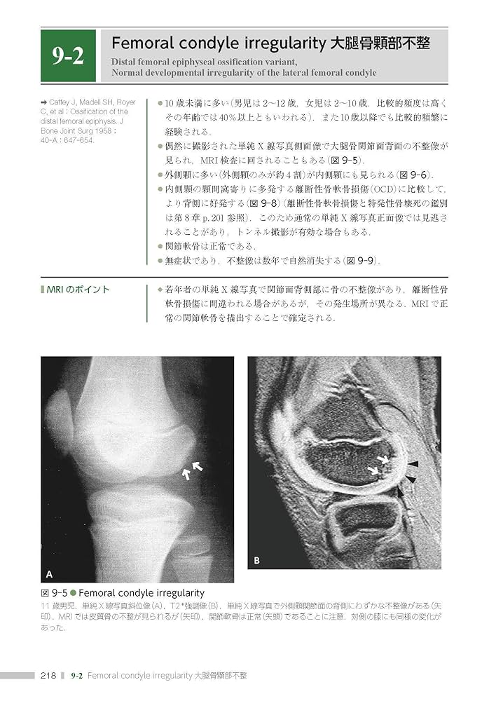 関節のMRI 第3版 関節のMRI 第3版 | 上谷雅孝, 青木隆敏, 神島 保, 江原 茂, 杉本