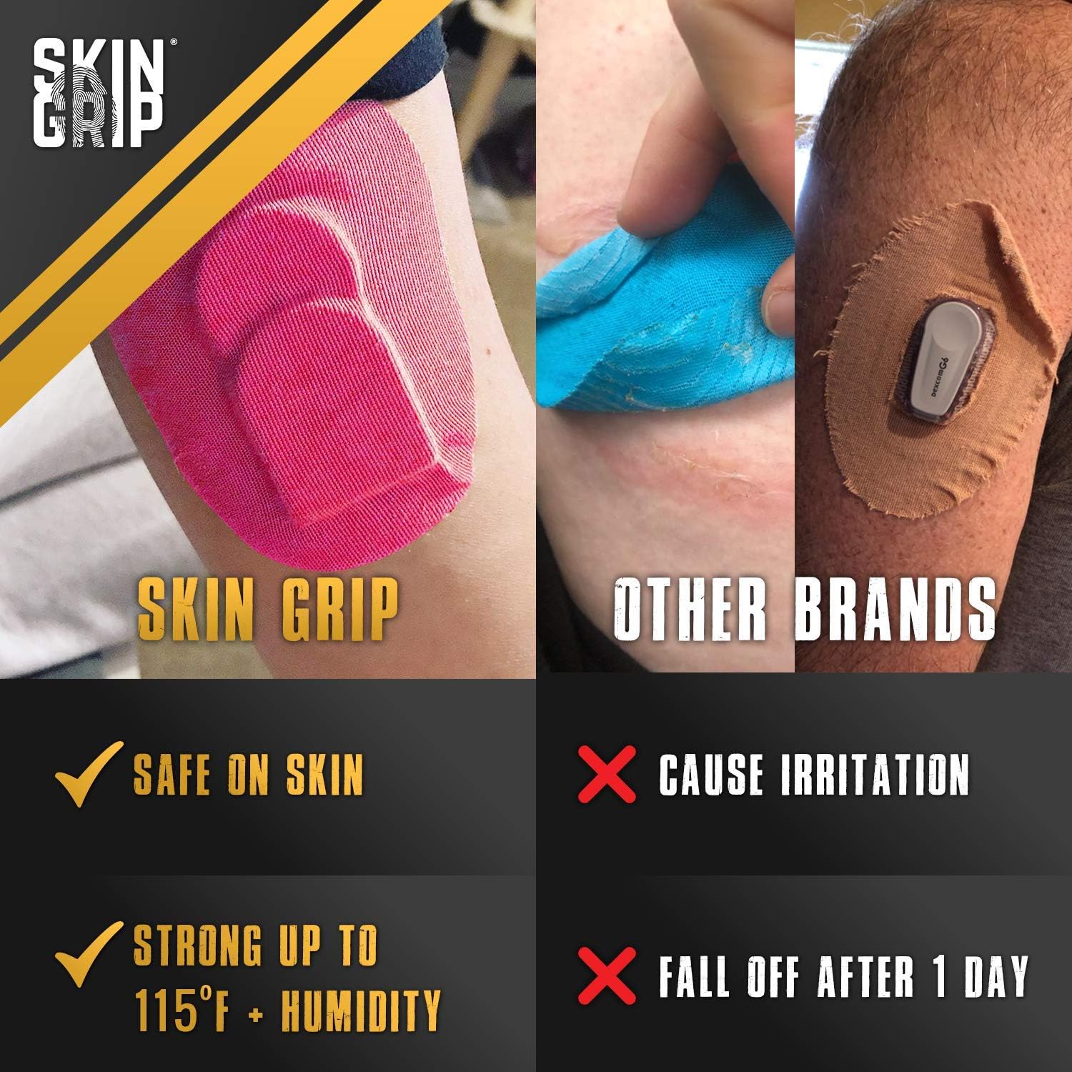 Skin Grip CGM Patches for Medtronic Guardian & Freestyle Libre (20-Pack), Waterproof & Sweatproof for 10-14 Days, Pre-Cut Adhesive Tape, Continuous Glucose Monitor Protection (Pink) : Health & Household