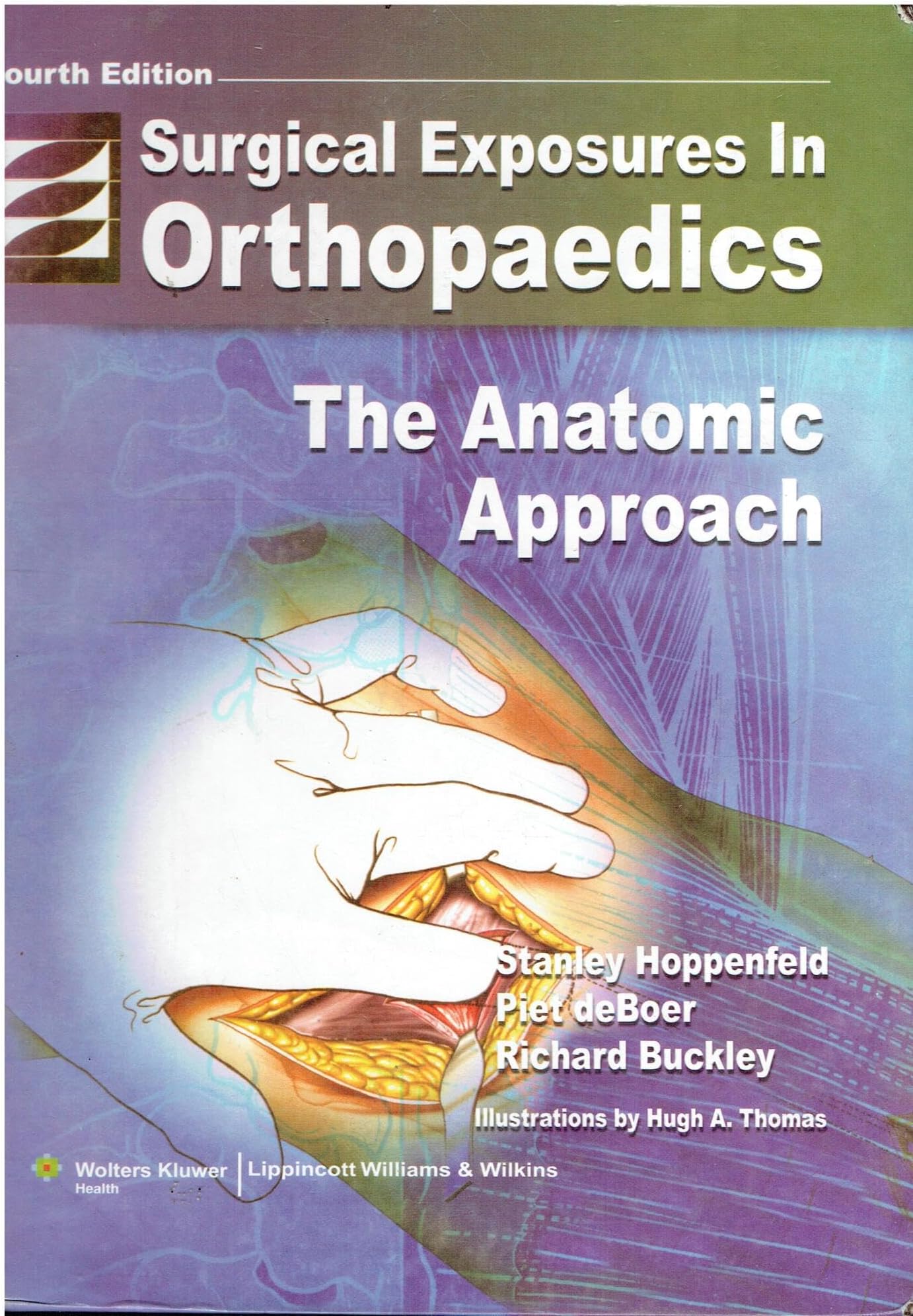 Surgical Exposures in Orthopaedics: The Anatomic Approach (Hoppenfeld, Surgical Exposures in Orthopaedics)