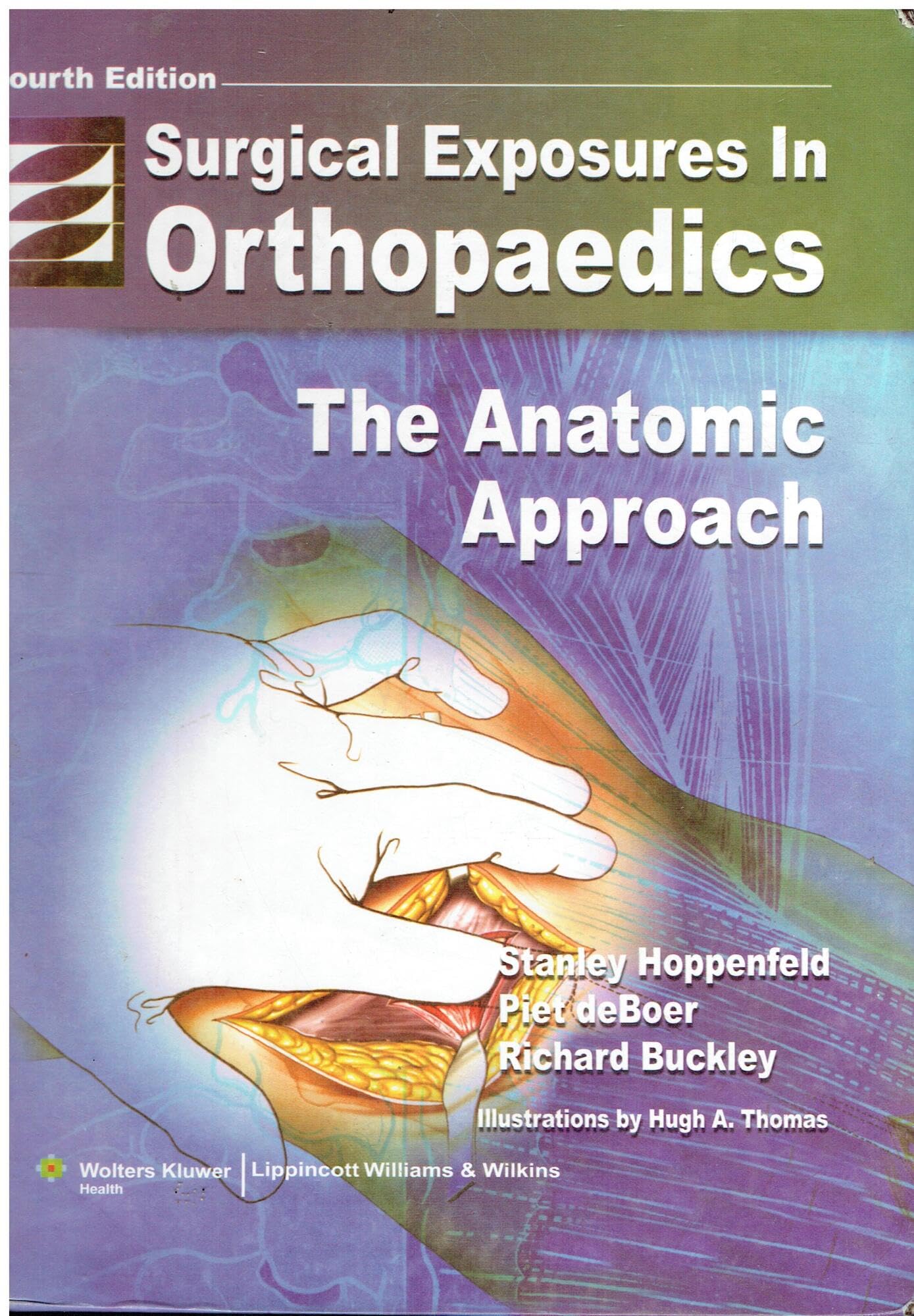 Surgical Exposures in Orthopaedics: The Anatomic Approach (Hoppenfeld, Surgical Exposures in Orthopaedics)