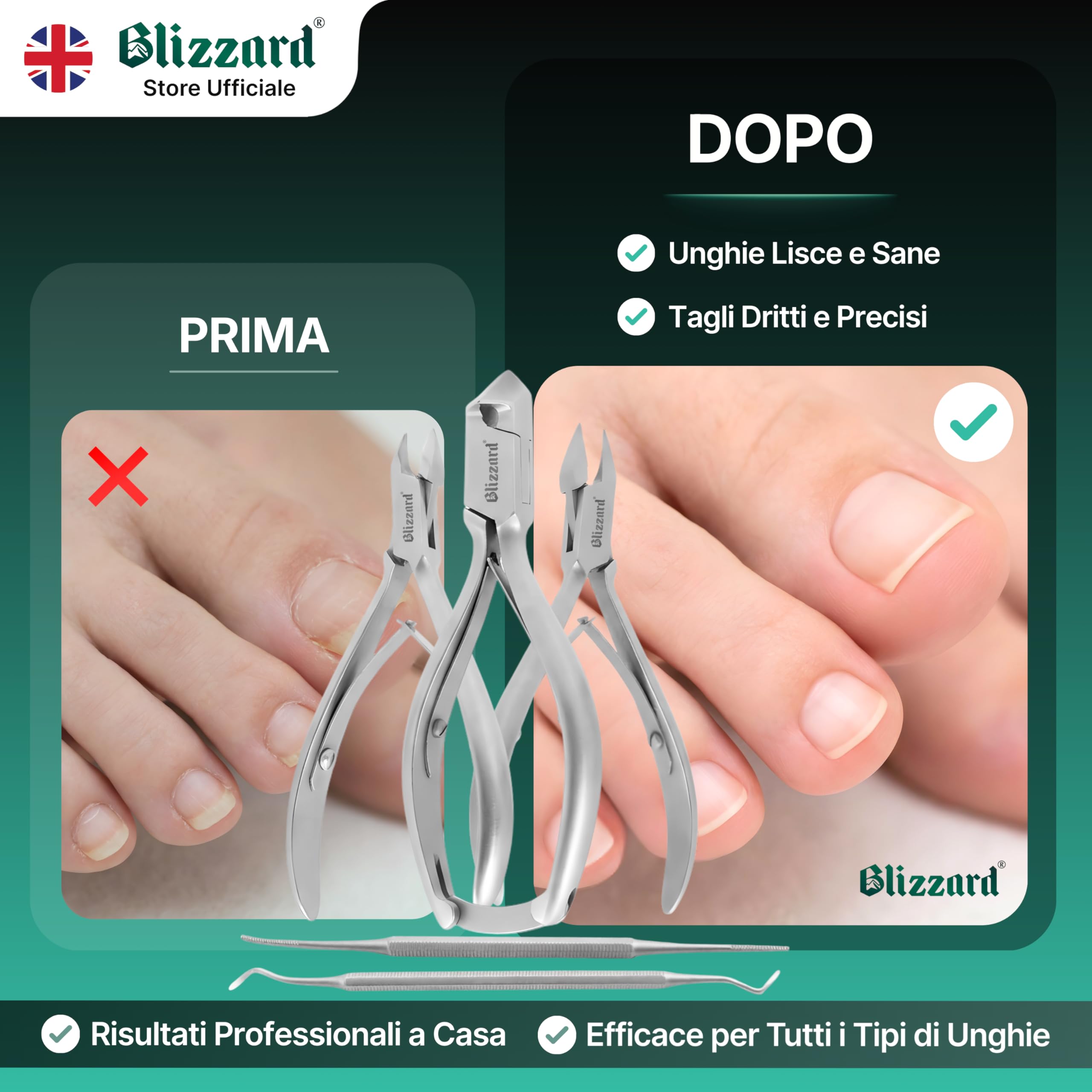 Blizzard Set Podologia Professionale 5 Pezzi - Kit Pedicure per Unghie Spesse e Incarnite - Tronchesino Unghie Piedi, Taglia Cuticole e Lima - Acciaio Inox - Per Anziani e Uomo