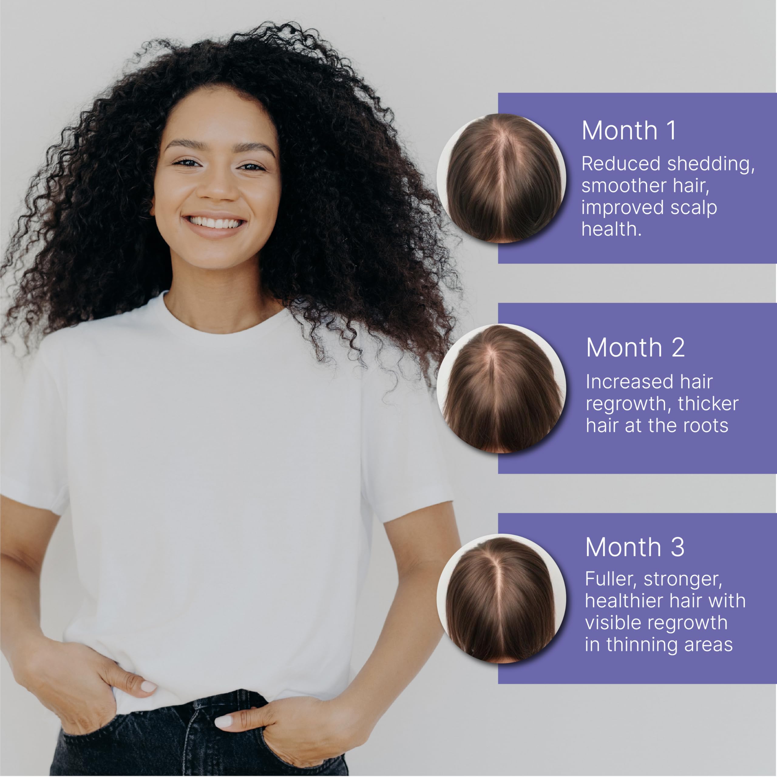 Tratamiento de pérdida de cabello posparto para mamás, aceite bloqueador de crecimiento del cabello DHT con romero, semillas de calabaza y aceite de semillas negras, natural y seguro para adelgazar el 7