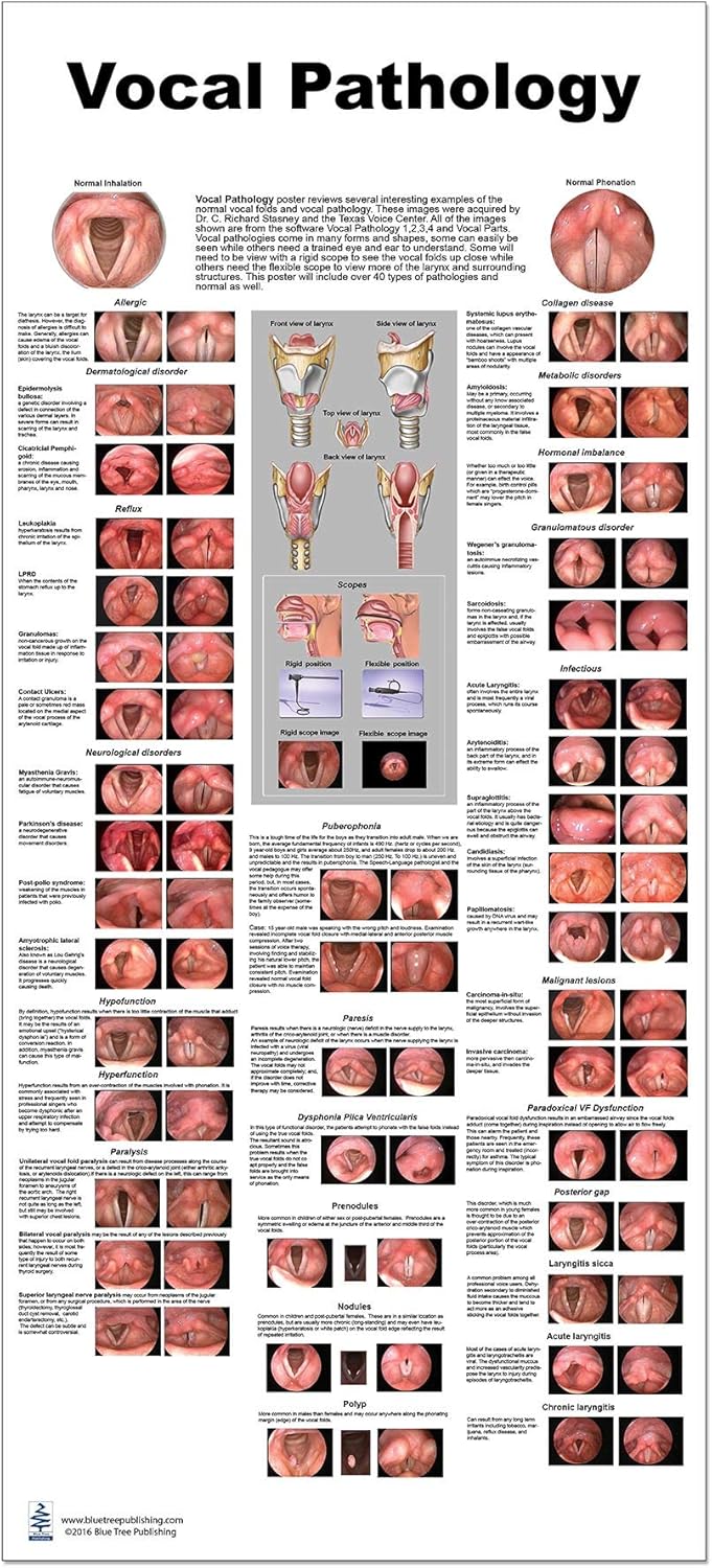 Blue Tree Publishing Vocal Pathology Lp Poster, 24x54inch, Water Proof, Dry-eraser Proof,scope view, vocal folds