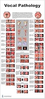 Blue Tree Publishing Vocal Pathology Lp Poster, 24x54inch, Water Proof, Dry-eraser Proof,scope view, vocal folds