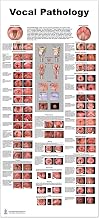 Blue Tree Publishing Vocal Pathology Lp Poster, 24x54inch, Water Proof, Dry-eraser Proof,scope view, vocal folds