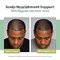 Vista 6 de Aceite de batana crudo 100% natural para el crecimiento del cabello, sin refinar y orgánico Dr Sebi aceite para el crecimiento del cabello