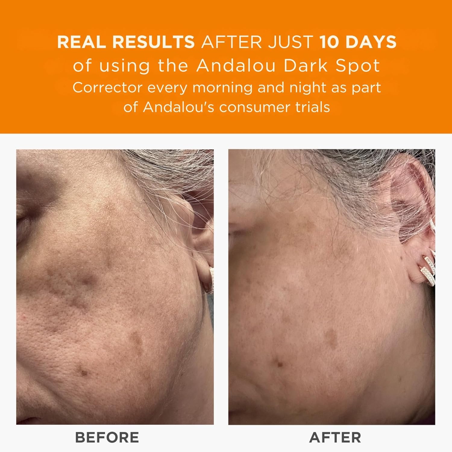 Andalou Naturals Dark Spot Corrector, Complexion Enhancing Face Serum with Vitamin C, May Help Hyperpigmentation, Reduce the Appearance of Acne Scars, Age Spots & UV Damage, 1 Oz - Image 4