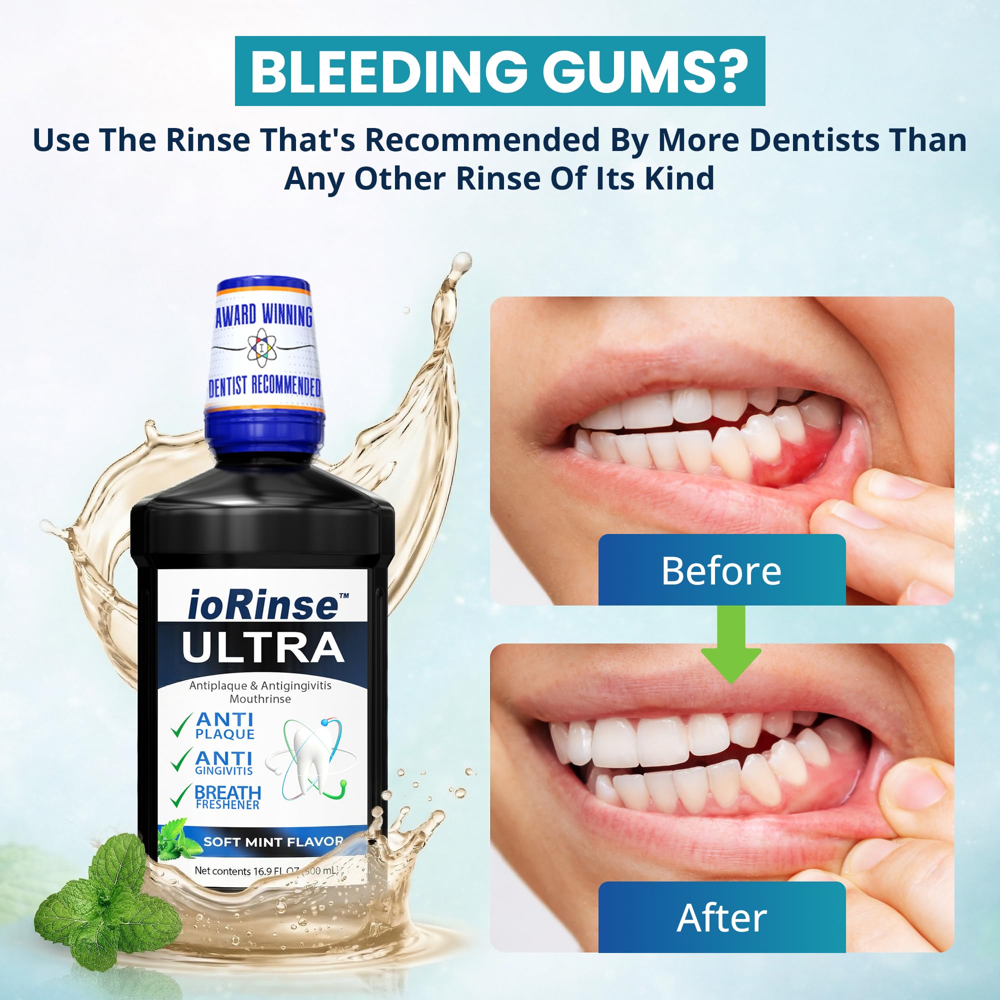 Gingivitis Rinse Snapklik.com : ioRinse Ultra Periodontal Rinse & Gum Mouthwash, Alcohol ...