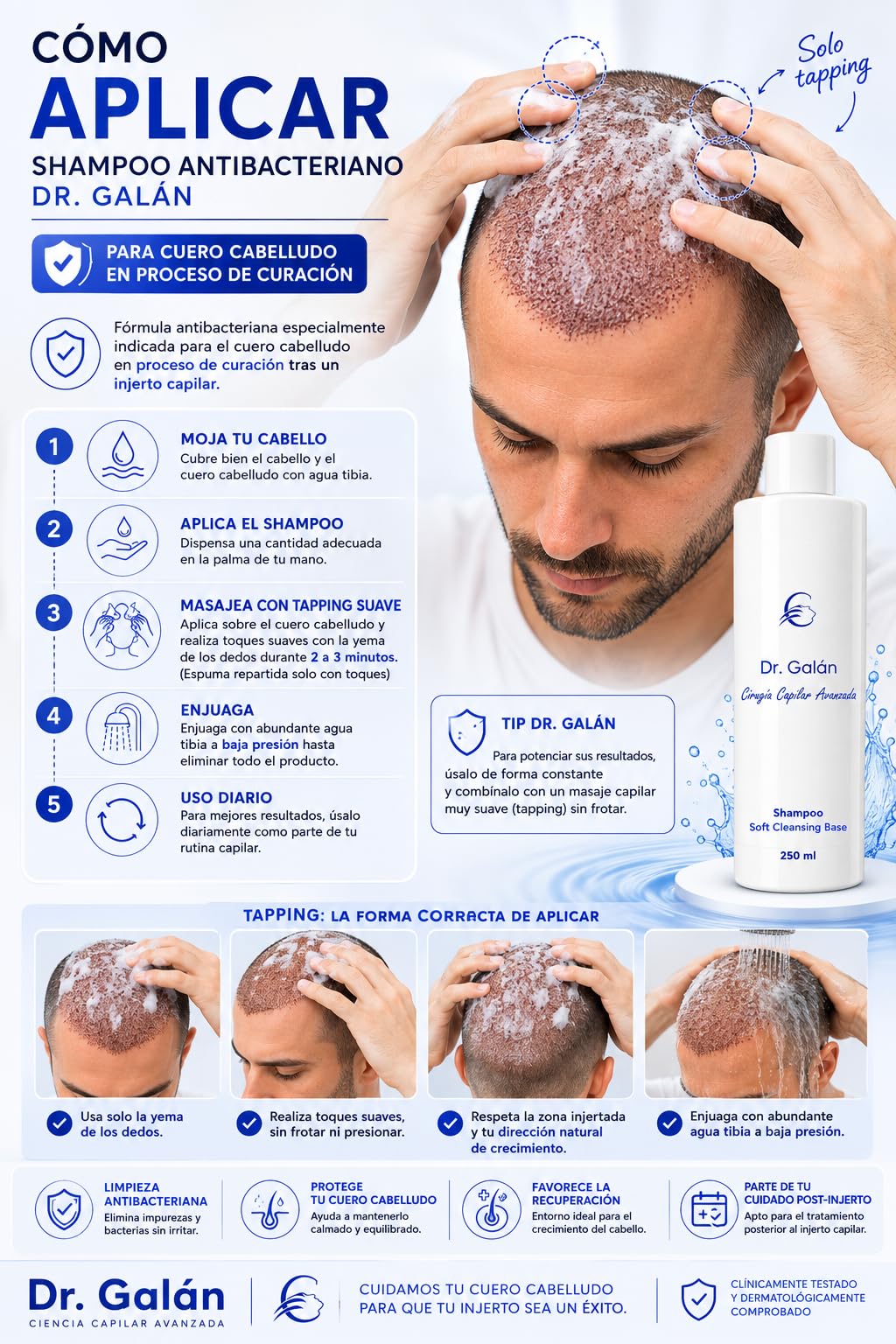 Pack Integral Postcirugía Capilar - Champú Post Injerto, Espuma Reparadora y Spray Calmante para Cuero Cabelludo Dañado - Tratamiento Completo