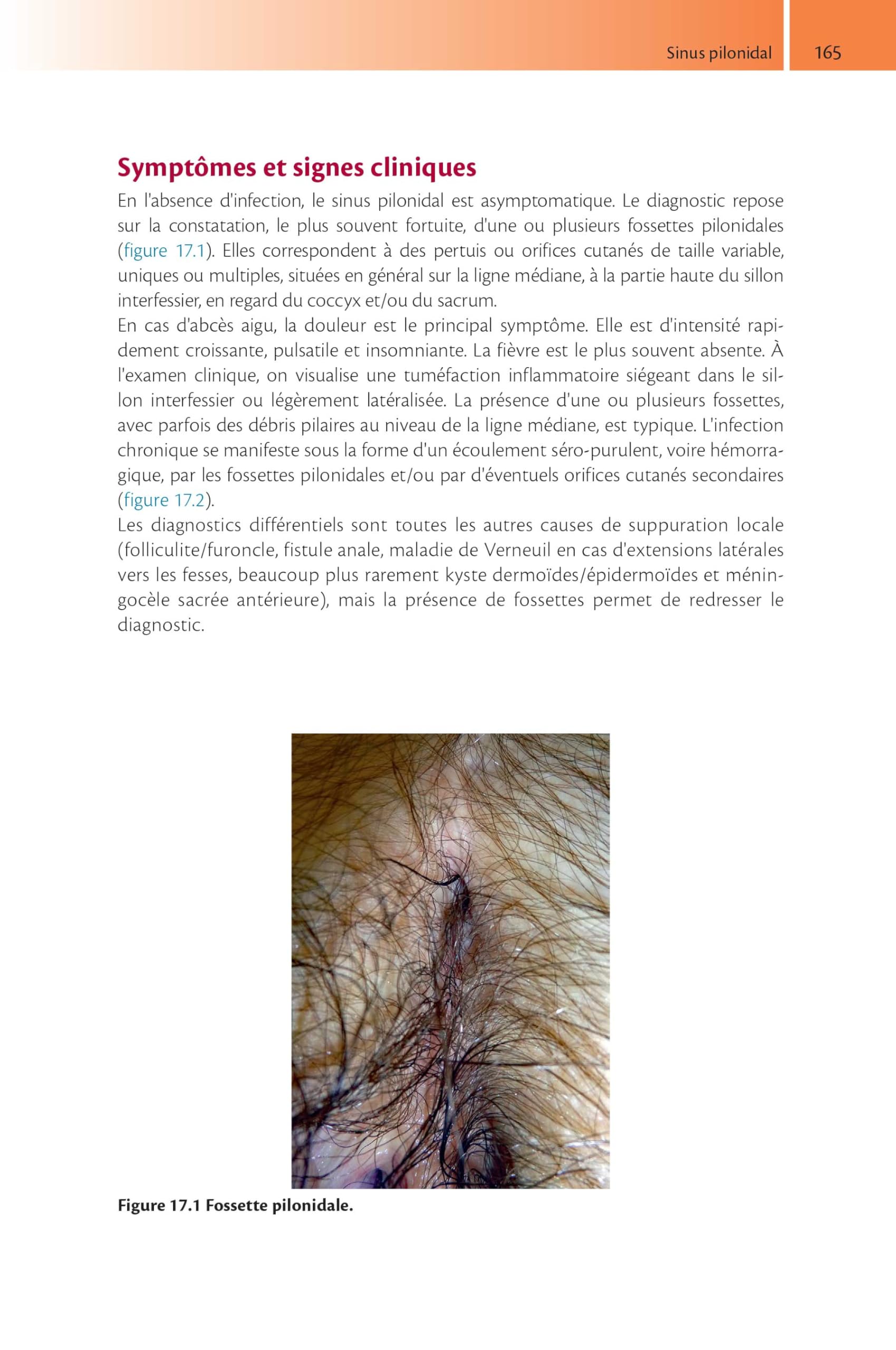 Tout-en-un de proctologie
