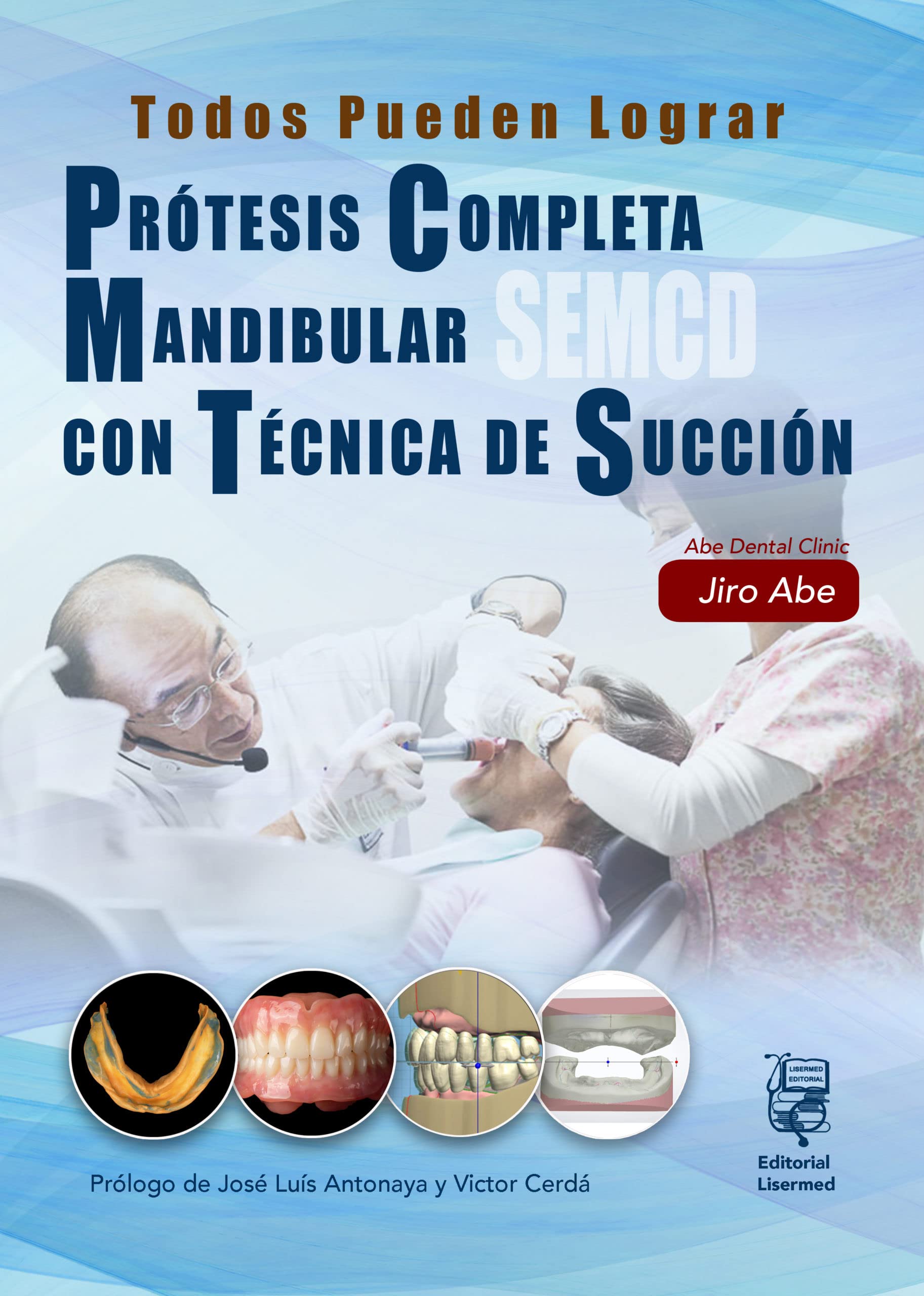 PRÓTESIS COMPLETA MANDIBULAR CON TÉCNICA DE SUCCIÓN SEMCD: TODOS PUEDEN LOGRAR