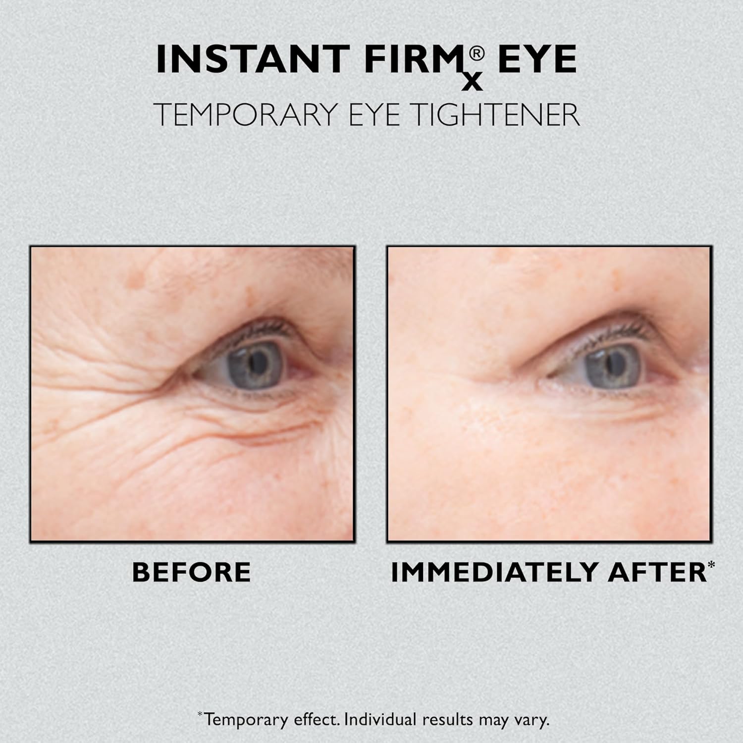 Peter Thomas Roth Instant Firmx Eye Cream: Réduit Rides et Cernes Instantanément - Description