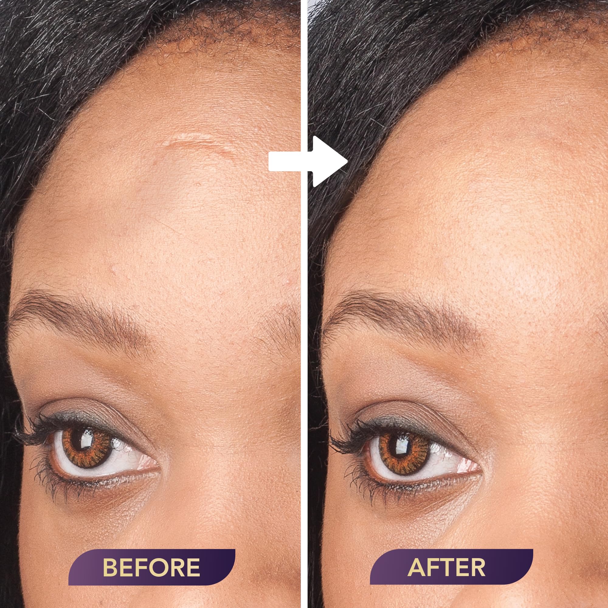Dermaflage Extended Wear Primer for use with Dermaflage Topical Filler product thumbnail 7