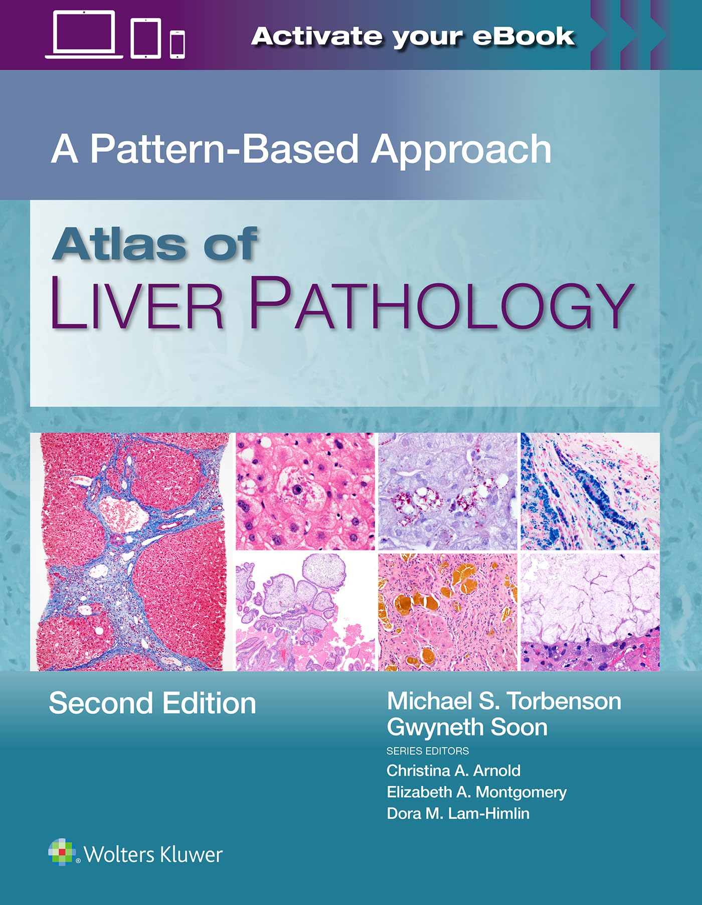 Atlas of Liver Pathology: A Pattern-Based Approach
