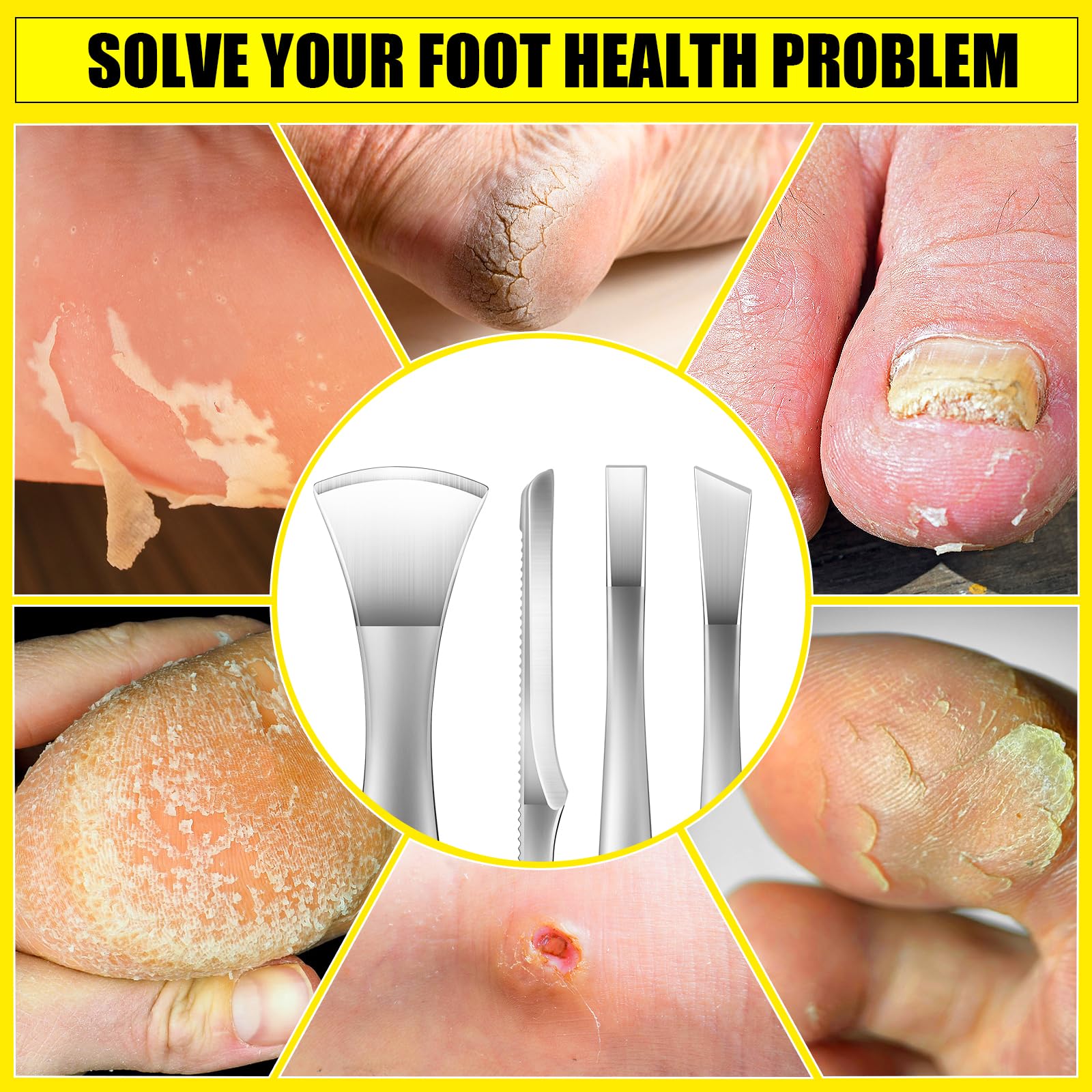 Zestaw noży do pedicure, profesjonalne narzędzia do pedicure do stóp, zestaw ostrzy do usuwania wrastających paznokci, narzędzie do usuwania kukurydzy ze stali nierdzewnej, skrobaczka do stóp, ostrza