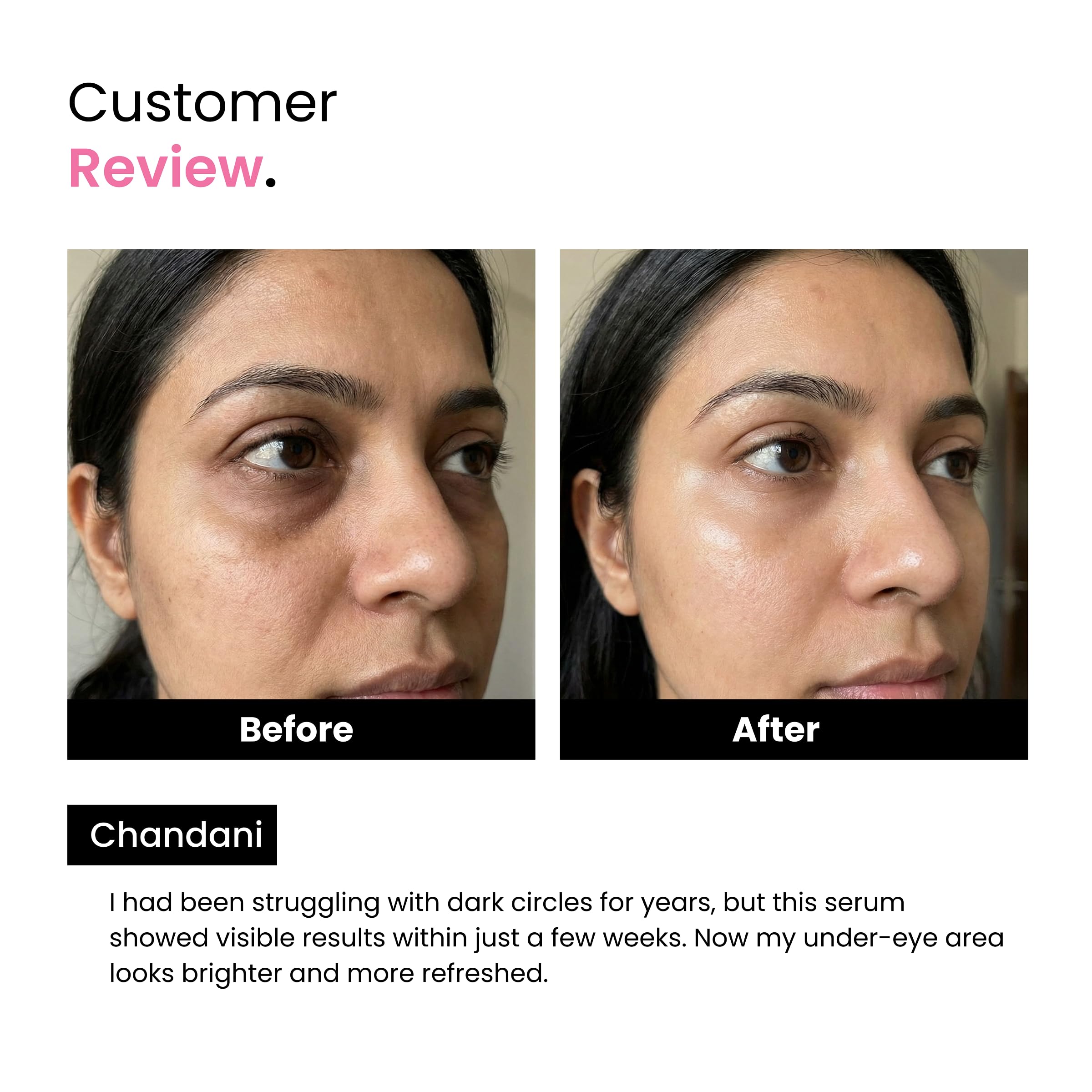 Ayumcure Anti Dark Circle Eye Serum – With 5% Niacinamide, 2% Hyaluronic Acid, Vitamin E & SPF 70+++ | Brightening & Hydrating Under Eye Care | For Dark Circles & Fine Lines | 50ml — Amazon image 5