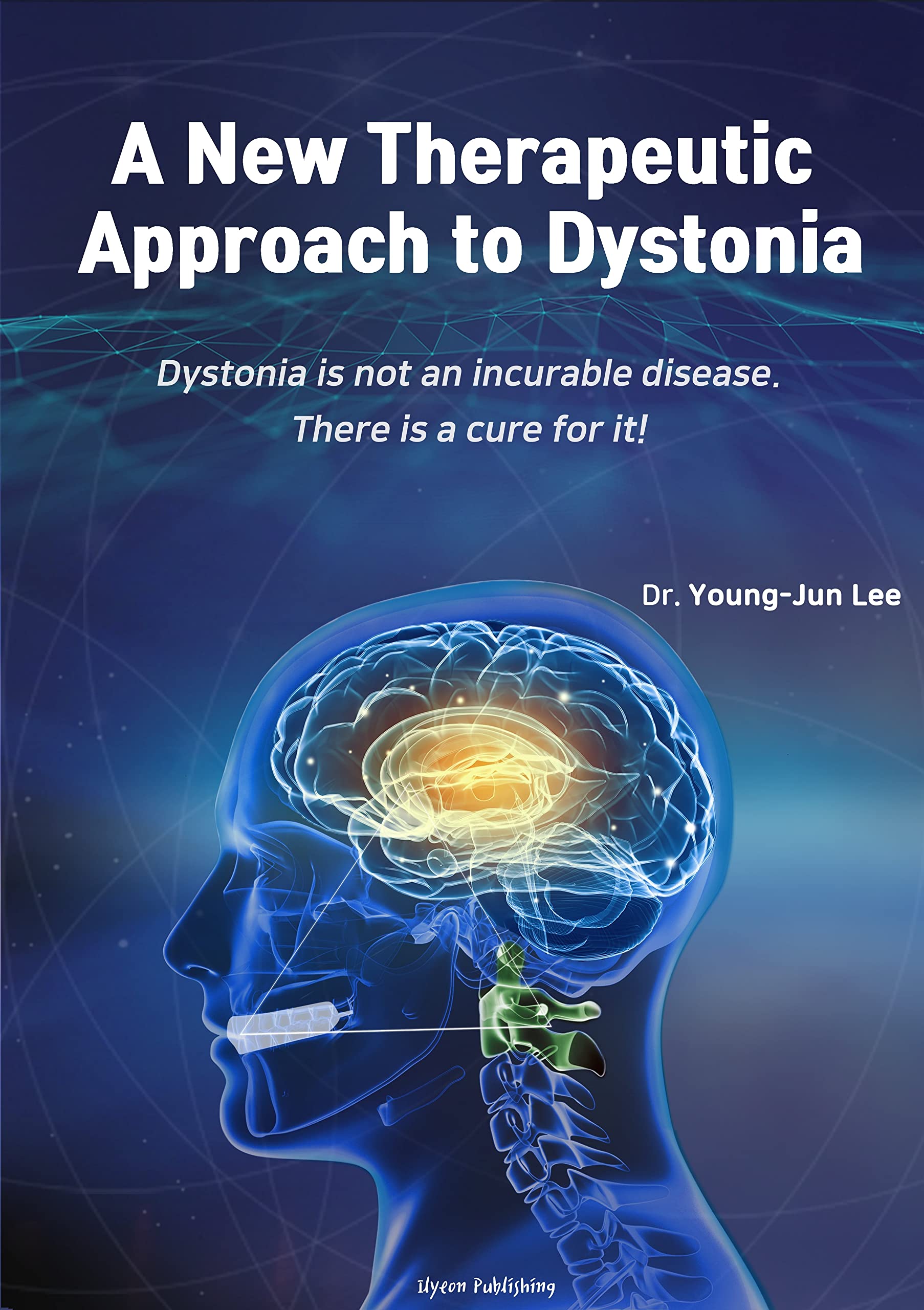 A New Therapeutic Approach to Dystonia: Dystonia is not an incurable disease. There is a cure for it.